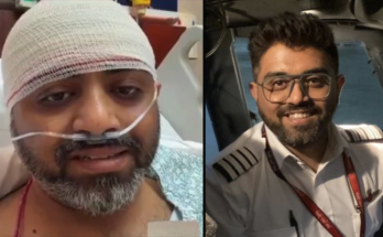 Capt Smit Machchhar Suffers Skull Fracture, Vision Severely Blurred
